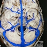 Luis Borba's Neurosurgical Channel