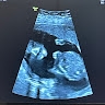 Jehoshaphat Commandest