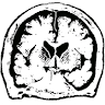 Grupo Estudos Envelhecimento Cerebral e Demência