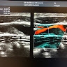 Vascular Surgery