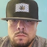 Anomaly DME